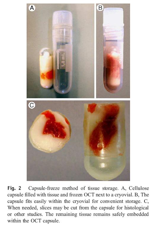 Cryomatrix2