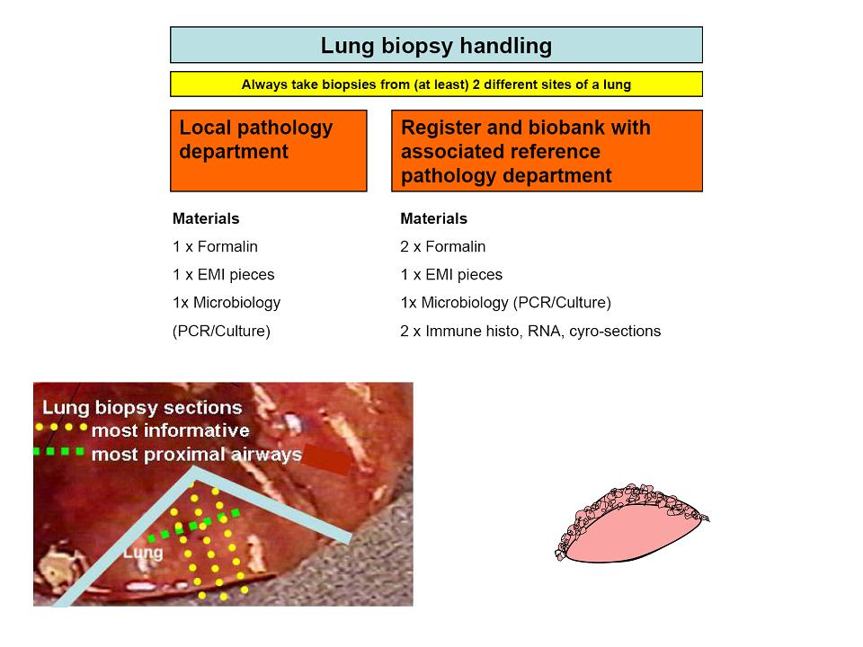 Schema_Lungenbiopsie_bersicht_Aufarbeitung